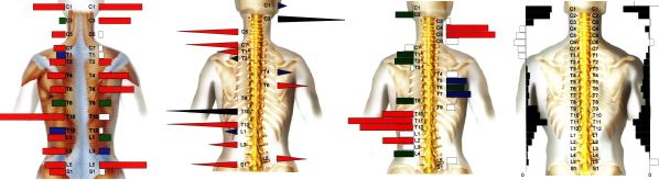 ch1-154jpg。 肩コリ（肩の痛み）で悩んでいる人の整体、カイロプラクティックの治療。 慢性的な肩凝りで悩んでいる人のほとんどは、病院（整形外科など…）の治療を受けたりマッサージや鍼治療をしたりしています。 しかし、の大多数は、肩凝り（肩の痛み）を何度も繰り返し治ることはありません。 肩コリ（肩の痛み）は、生活習慣と密接な繋がりがあり、日用生活を変えなければ、根本的に治癒するのは難しいものです。 肩こりに生活環境が、どのように関係するのでしょうか？それは生活習慣が人体の骨格を歪ませるからです。 歪んだ骨格は、神経や血管を圧迫し、さらに筋肉や骨格に想像以上の大きな負荷をかけ筋肉や骨格を疲れさせます。 整体やカイロプラクティックでは、脊椎、骨盤などを矯正し体のバランスを理想的な状態にします。 浜松市南区で口コミで評判の整体なら、こちらがおススメです。 肩凝り（肩の痛み）には、整体の脊椎の矯正がとても効果があります。 浜松市南区で口コミで評判の整体やカイロプラクティックをお探しなら、こちらまで。