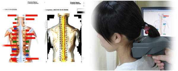 ch1-272jpg。 肩こりで困っている人の整体の脊椎矯正。 慢性の肩凝り（肩の痛み）で困っている人の多くは、病院（整形外科など…）の治療を受けたり鍼治療やマッサージを受けたりしています。 だけれども、の大半は、肩こり（肩の痛み）を何度も繰り返し根本的に治すことができません。 肩凝りは、生活習慣と密接なつながりがあり、日用生活を改善しなければ、根本的に治すのは難しいものです。 肩こりに生活習慣が、どうして関係するのでしょうか？それは生活習慣が人間の背骨を歪ませるからです。 歪んだ背骨は、神経を圧迫し、さらに筋肉や関節にとても大きな負担をかけ筋肉や関節を疲れさせてしまいます。 整体やカイロプラクティックでは、背骨などを矯正し身体のバランスを理想的な状態にします。 浜松市南区で口コミで評判の整体やカイロプラクティックなら、こちらがお薦めです。 肩凝り（肩の痛み）には、整体やカイロプラクティックの背骨の矯正がとても効果的です。 浜松市南区で口コミで評判のカイロプラクティックや整体をお探しなら、こちらまで。