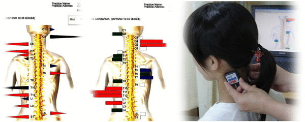 ch1-280gif。 肩コリには、整体やカイロプラクティックの脊椎の矯正が最も効果的です。 磐田市、周辺で口コミで評判のカイロプラクティックをお探しなら、こちらまで。 肩こりは、生活環境と密接な繋がりがあり、日用生活を改めなければ、根本的に治癒するのは難しいでしょう。 肩凝り（肩の痛み）で悩んでいる人のカイロプラクティック、整体の脊椎矯正。 慢性の肩コリ（肩の痛み）で悩んでいる人の多くは、病院の治療を受けたり接骨院の治療や鍼治療をしたりしています。 しかし、のほとんどは、肩凝りを幾度も再発し治ることはありません。 肩こりに生活環境が、どのように関係するのでしょうか？それは生活環境が人間の脊椎、骨盤を歪ませるからです。 歪んだ脊椎は、神経や血管を圧迫し、さらに筋肉や関節にとても大きな負荷をかけ筋肉や骨格を疲れさせます。 カイロプラクティックや整体では、脊椎、骨盤などを矯正し身体のバランスを理想的な状態にします。 磐田市、周辺で口コミで評判の整体やカイロプラクティックなら、こちらがおススメです。