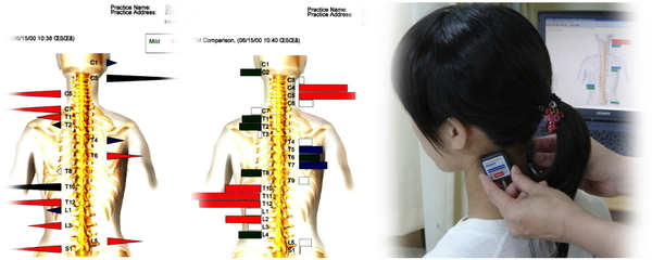 ch1-280png。 肩こり（肩の痛み）には、カイロプラクティックや整体の脊椎の矯正がとても効果的です。 磐田市、周辺で口コミで評判の整体やカイロプラクティックをお探しなら、こちらまで。 肩凝り（肩の痛み）は、生活習慣と密接な繋がりがあり、日用生活を改善しなければ、根本的に治癒するのは難しいでしょう。 肩凝りで悩む人の整体の背骨矯正。 慢性の肩こりで悩む人の大多数は、病院（整形外科など…）の診察を受けたりマッサージや鍼治療をしたりしています。 だけれども、の大半は、肩こりを幾度も再発し治ることはありません。 肩こりに生活環境が、どうして関係するのでしょうか？それは生活習慣が人体の脊椎、骨盤を歪ませるからです。 歪んだ脊椎、骨盤は、神経や血管を圧迫し、さらに筋肉や関節に想像以上の大きな負担をかけ筋肉や骨格を疲れさせてしまいます。 整体やカイロプラクティックでは、脊椎、骨盤などを施術し、骨格の状態を理想的な状態にします。 磐田市、周辺で口コミで評判の整体やカイロプラクティックなら、こちらがお薦めです。