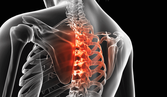 背中の痛み、背中の凝り、背骨の痛み、を解消する、カイロプラクティック、整体の矯正。