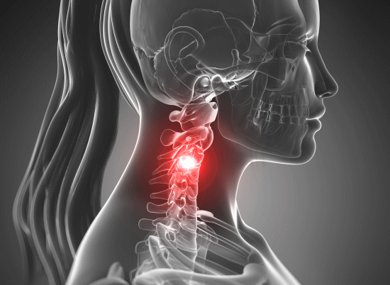 首の痛みと頸椎の歪みを矯正するカイロプラクティック、整体、整骨院の骨格矯正