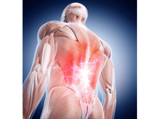 筋肉の損傷、筋膜の損傷、靭帯の孫陽による腰痛。
