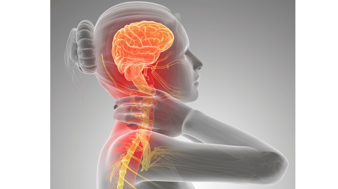 首の痛みとカイロプラクティック、整体、整骨院の治療