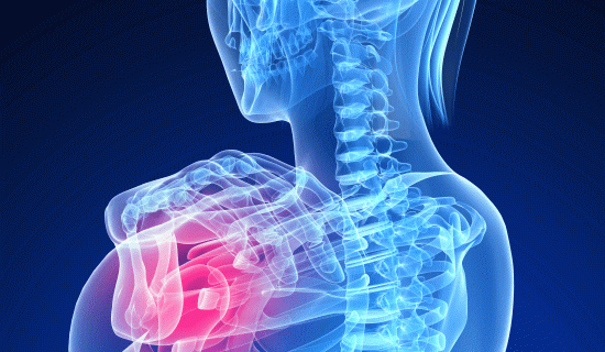 「肩凝り」の治し方と整体とカイロプラクティックの治療法