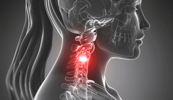 「首の痛み」を改善する整体とカイロプラクティック