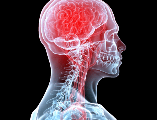 頭痛の痛みを解消するカイロプラクティック、整体、整骨院の背骨矯正