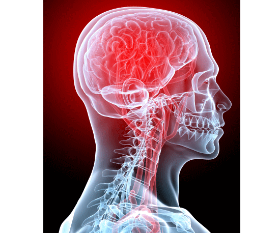 頭痛の治し方と頭痛を治す浜松市のカイロプラクティック、整体、整骨院
