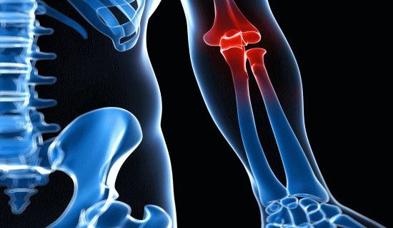 「肘の痛み」と整体とカイロプラクティックの治療