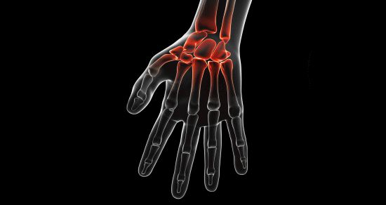 「手首の痛み」と整体とカイロプラクティックの治療