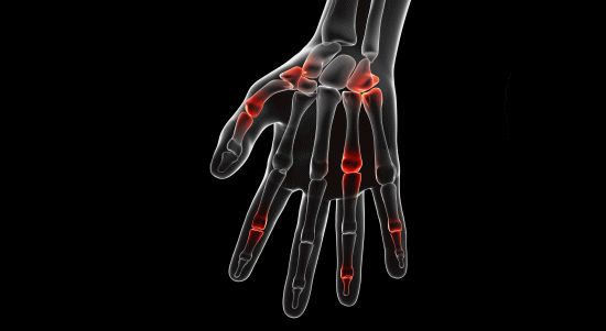 「手の痛み」や「手の痺れ」と整体とカイロプラクティックの治療