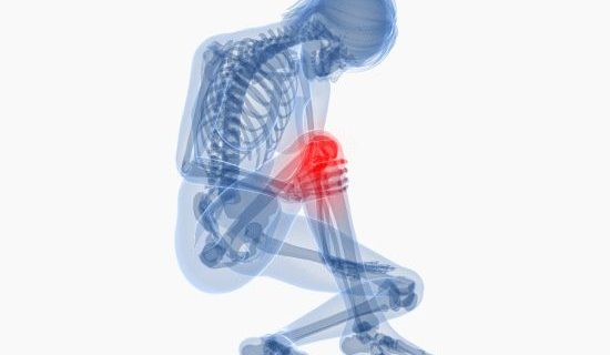 「膝の痛み」の整体とカイロプラクティックの治療
