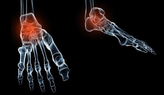 「足首の痛み」と整体とカイロプラクティックの治療