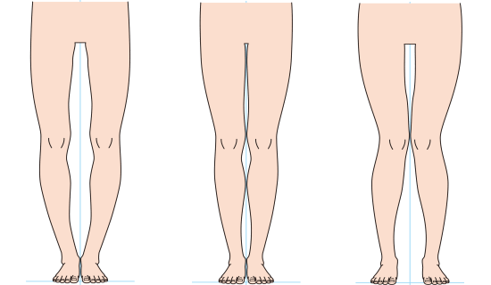 浜松市の「o脚の矯正」「x脚の矯正」をしている整体とカイロプラクティック
