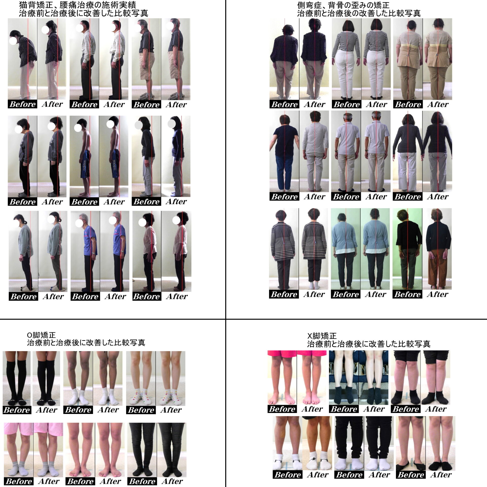 カイロプラクティック 施術実績 Before After